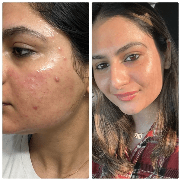 Collagen Night Wrapping Peel Off Mask (Buy 1 Get 1) - Zoodo