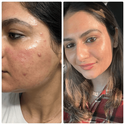 Collagen Night Wrapping Peel Off Mask (Buy 1 Get 1) - Zoodo