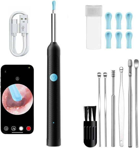 360° Smart Earwax Cleaner with Camera – WiFi Visual Otoscope Tool - Zoodo